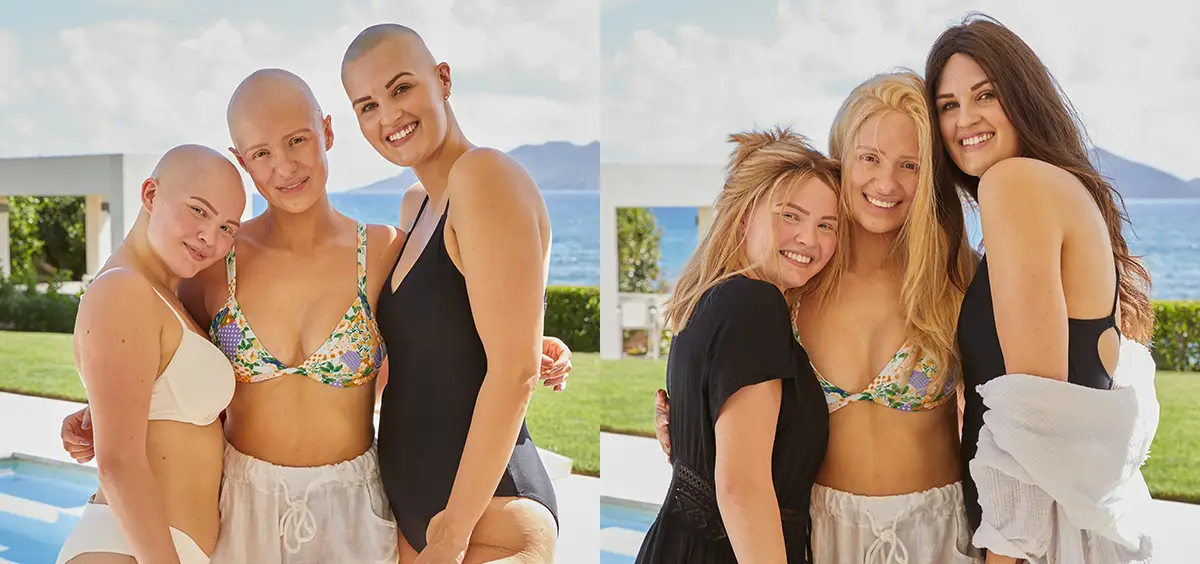 Human Hair Wigs in Toronto: A Natural Solution for Women with Alopecia Human Hair Wigs in Toronto: A Natural Solution for Women with Alopecia